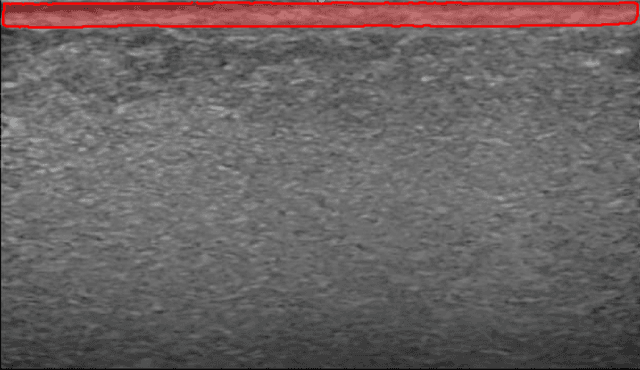 Overview of Dermis Analysis